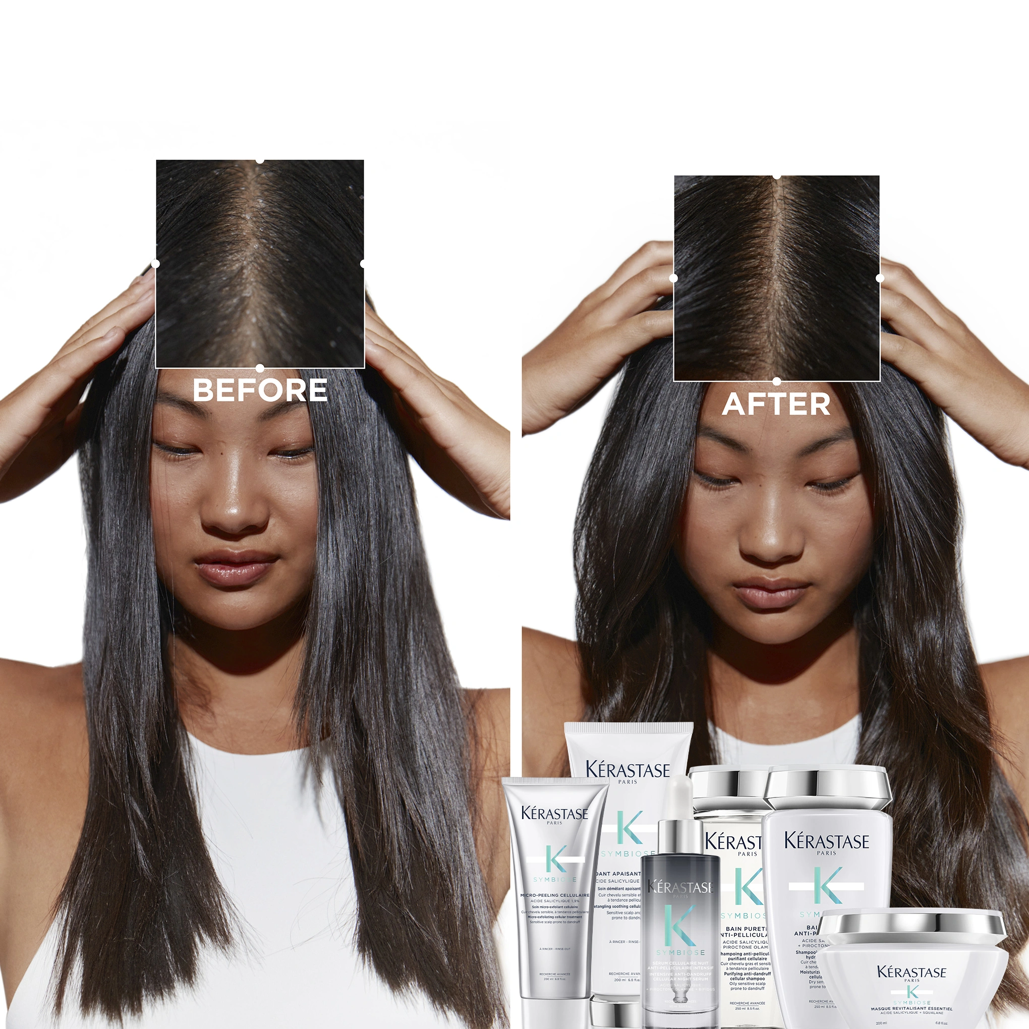 Kérastase Symbiose Bain - Pureté Anti-Pelliculaire - 250ml képe 4
